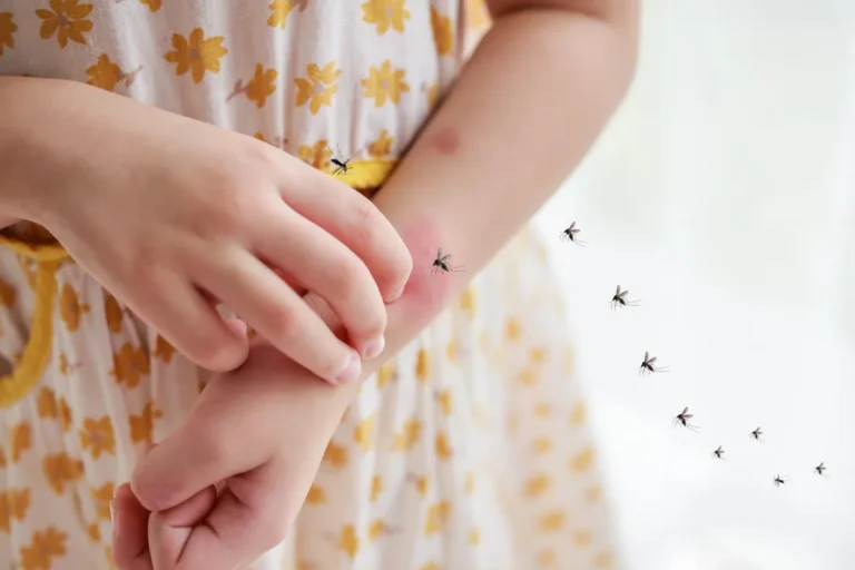 mosquito bite